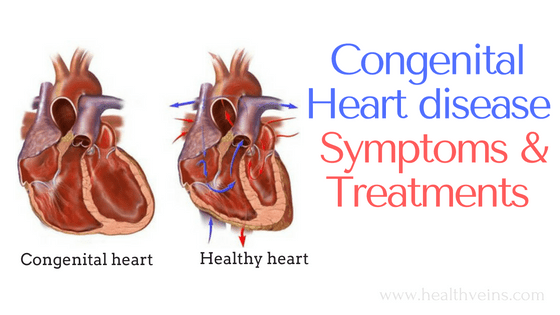 Congenital heart disease in infants symptoms